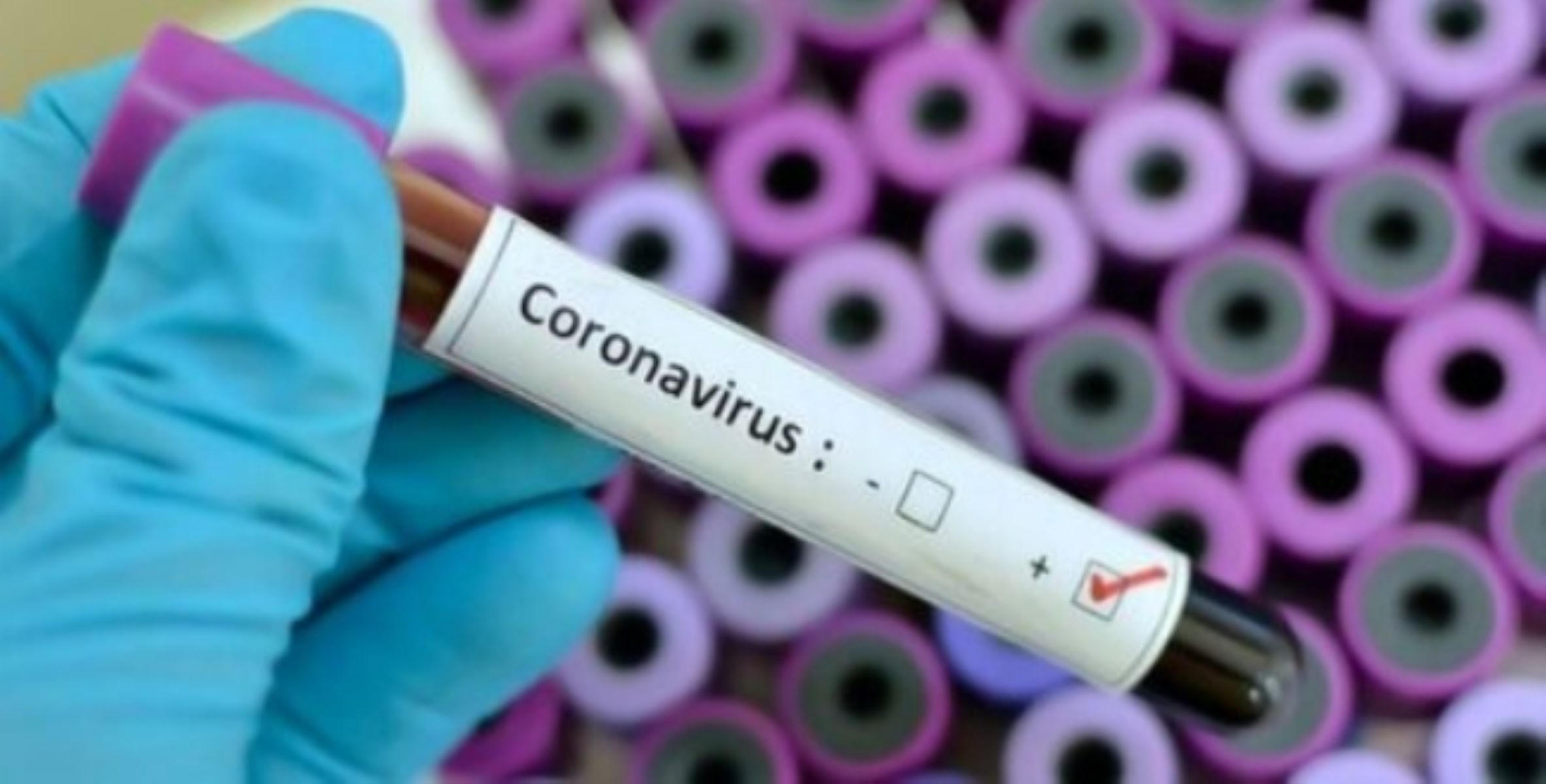 எத்தனை வகை டா சாமி! மீண்டும் உலக நாடுகளில் உலா வரும் புதிய வகை கொரோனா!