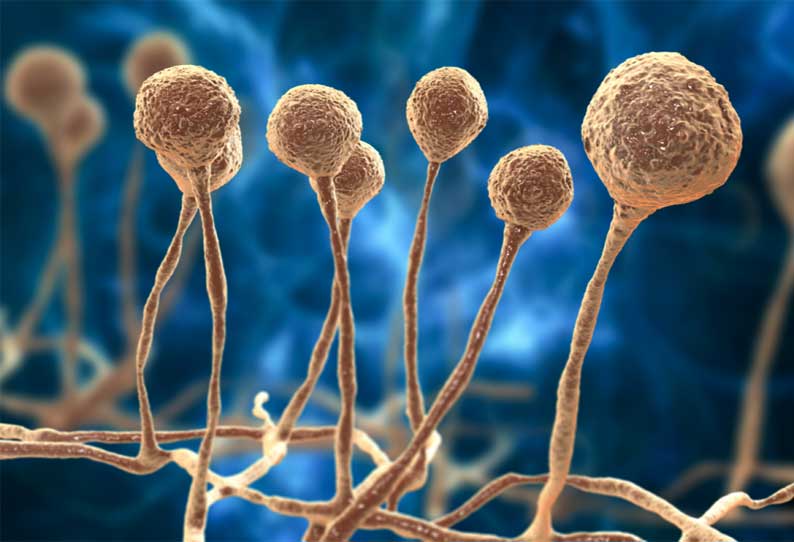 இத்தனை பேருக்கு கருப்பு பூஞ்சை பாதிப்பா? அதுவும் கோவையில் மட்டும்!