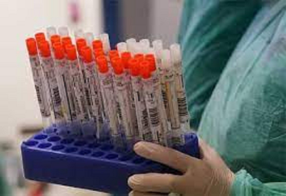 இனி இவர்களுக்கு ஆர்.டி.பி.சி.ஆர் என்னும் கொரோனா பரிசோதனை செய்ய  தேவையில்லை!