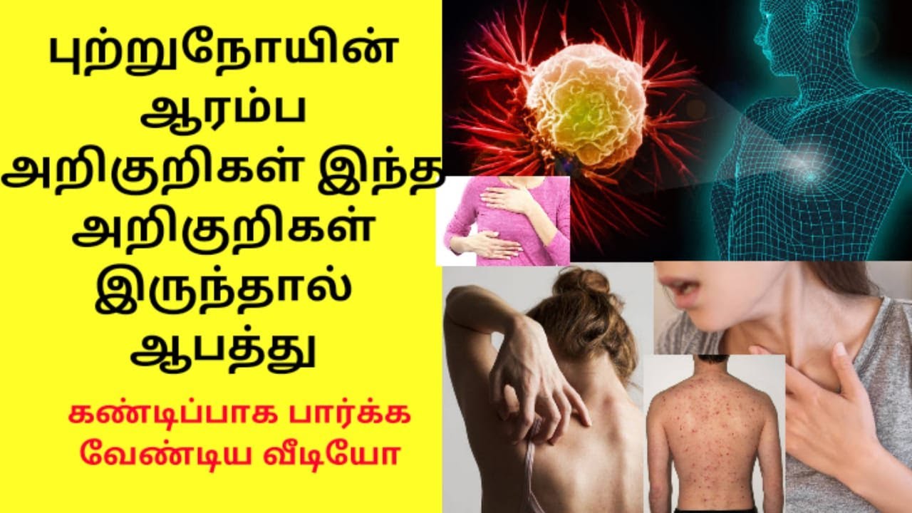 உங்களுக்கு இந்த அறிகுறிகள் இருந்தால் வயிற்றுப் புற்று நோய் தான்!! உடனே தெரிந்து கொள்ளுங்கள்!!