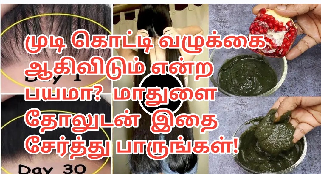 முடி கொட்டி வழுக்கை ஆகிவிடும் என்ற பயமா? மாதுளை தோலுடன் இதை சேர்த்து  பாருங்கள்! - News4 Tamil : Tamil News | Online Tamil News Live | Tamil News  Live | News in Tamil 