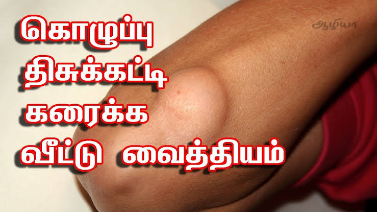 கொழுப்பு கட்டி ஒரே வாரத்தில் குணமாக வேண்டுமா? இந்த பேஸ்டை வைத்து மாசாஜ் செய்தால் போதும்!