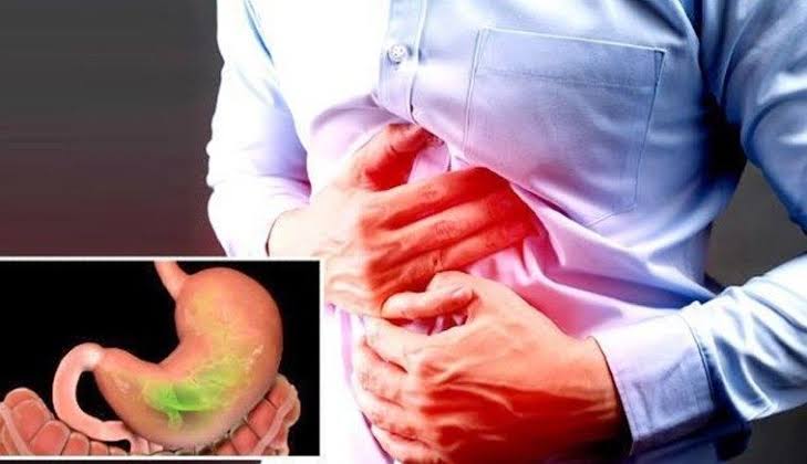 அல்சர் ஏற்பட காரணம்! இந்த உணவை முற்றிலும் தவிர்த்துக் கொள்ள வேண்டும்!