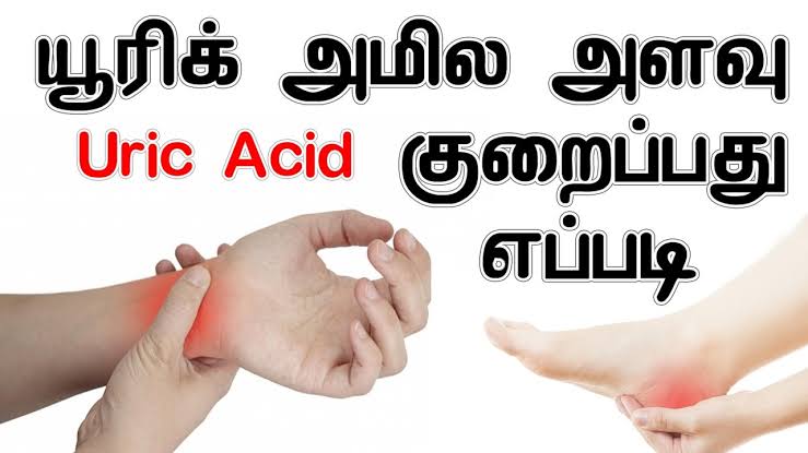 யூரிக் அமிலத்தை முற்றிலும் குறைத்து மூட்டு வலி வீக்கம் கை கால் முகம் வீங்குதல் சரியாக!