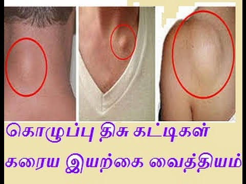 கொழுப்பு கட்டி கரைய! ஒரு ஸ்பூன் மஞ்சள்!