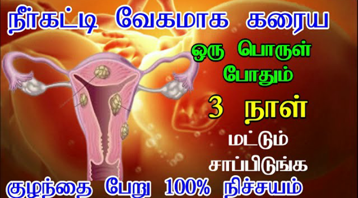 கர்ப்பப்பை நீர்க்கட்டி கரைய இதனை 3 நாள் சாப்பிடுங்கள்!! 100% குழந்தை பேரு நிச்சயம்!!