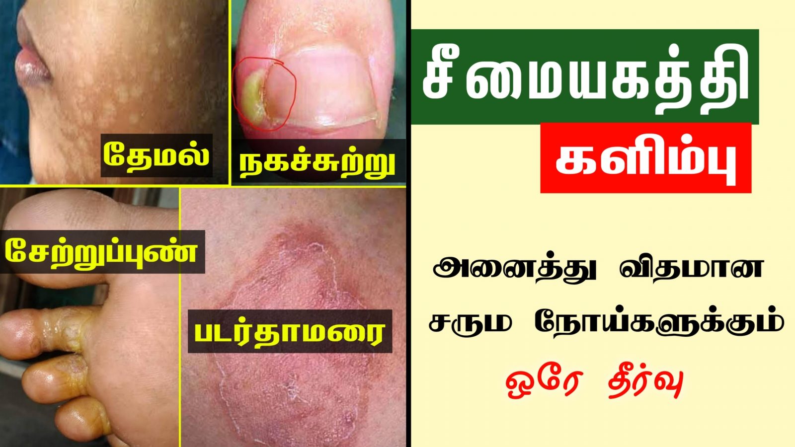 சேற்றுப்புண்ணால் அவதிப்படுகிறீர்களா?? இனி செலவே இல்லாமல் 3 நாளில் விரட்டலாம்!!