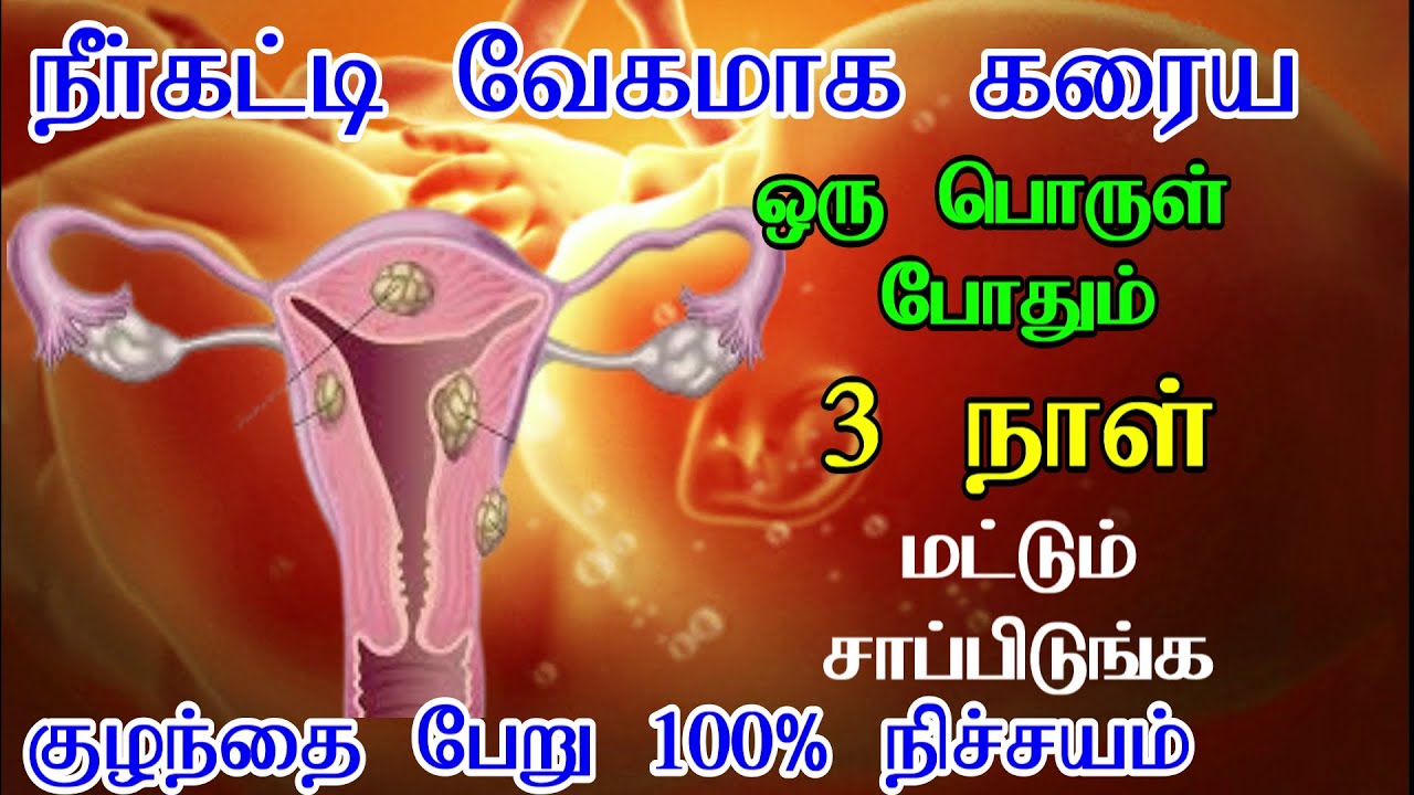 நீர்கட்டி வேகமாக கரைய ஒரு பொருள் போதும்!! 3 நாட்கள் மட்டும் சாப்பிடுங்கள்  நிச்சயம் குணமாகும்!!